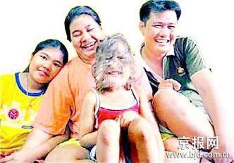 组图:泰国7岁女孩患罕见多毛症 貌似狼孩 (3)