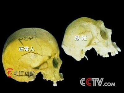 图文:人猿杂交?揭开神农架猴娃身份之谜 (12